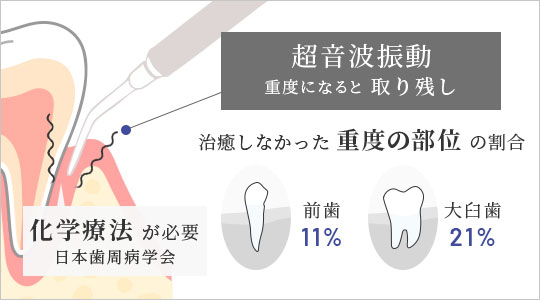 従来の歯周治療